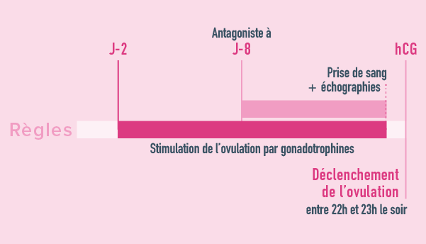Echographie : Follicule mature (à gauche) / Muqueuse utérine triple feuillet ( à droite)